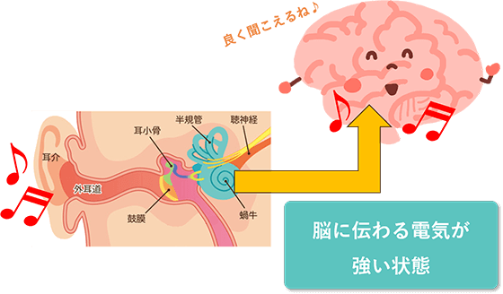 脳に伝わる電気が強い状態