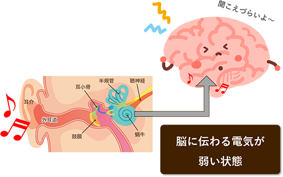 脳に伝わる電気が弱い状態