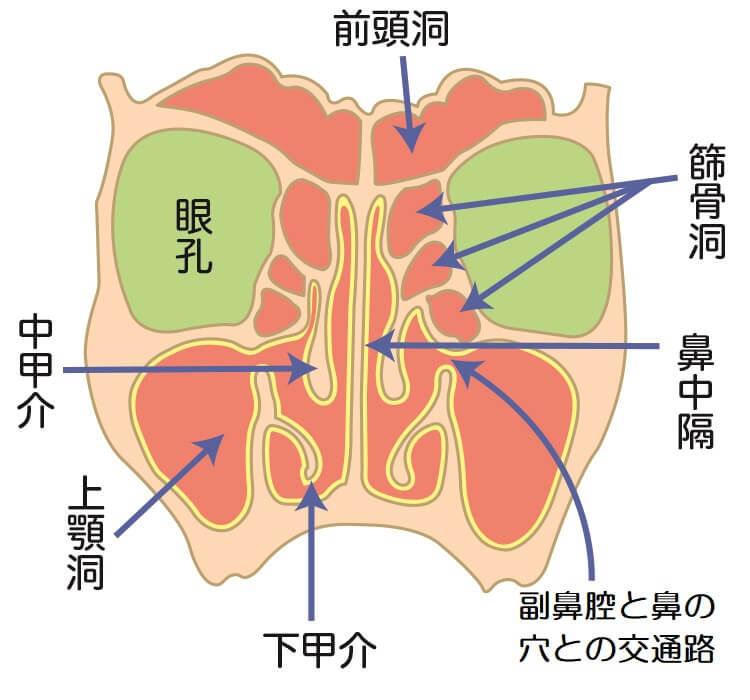 副鼻腔炎